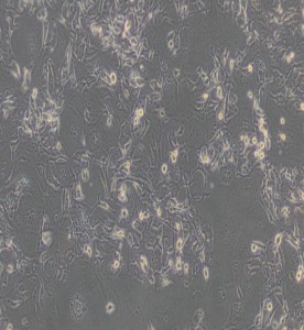 HCCC-9810人膽管細胞型肝癌細胞主圖