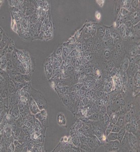 HuH-6人肝母細(xì)胞瘤細(xì)胞主圖