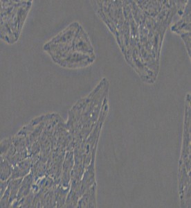 Li-7人肝癌細(xì)胞主圖