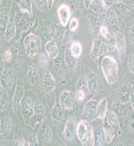 NCI-H661人大細胞肺癌細胞主圖