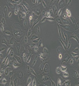 OS-RC-2人腎癌細胞主圖