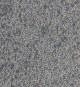 NAMALWA人Burkitt's淋巴瘤細胞主圖