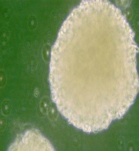 NK-92MI人惡性非霍奇金淋巴瘤患者的自然殺傷細胞主圖