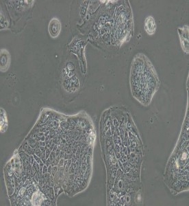 SW1116人結腸腺癌細胞(L15)主圖