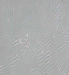 CCD-1095Sk人乳腺浸潤性導(dǎo)管癌旁皮膚細(xì)胞主圖