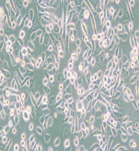 PC-9人肺癌細胞主圖